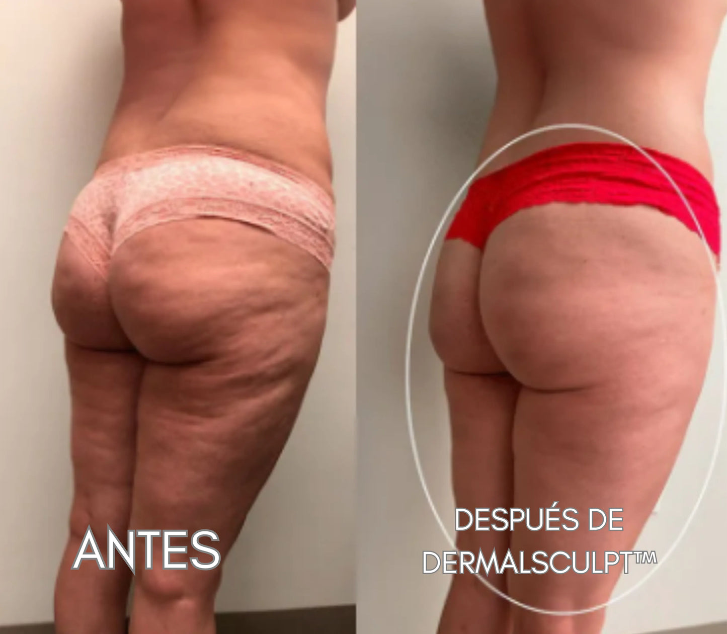 DERMALSCULPT™