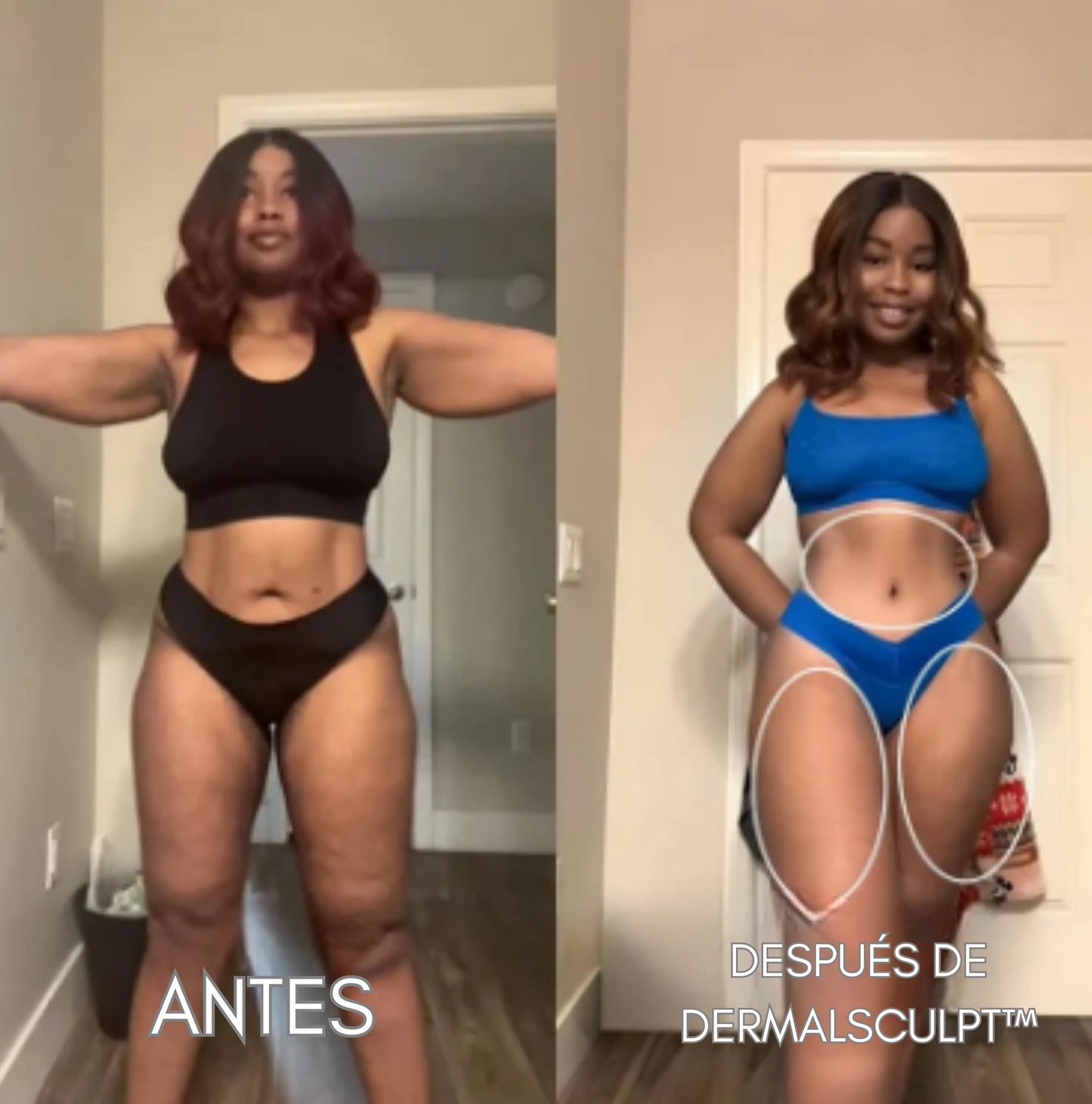 DERMALSCULPT™