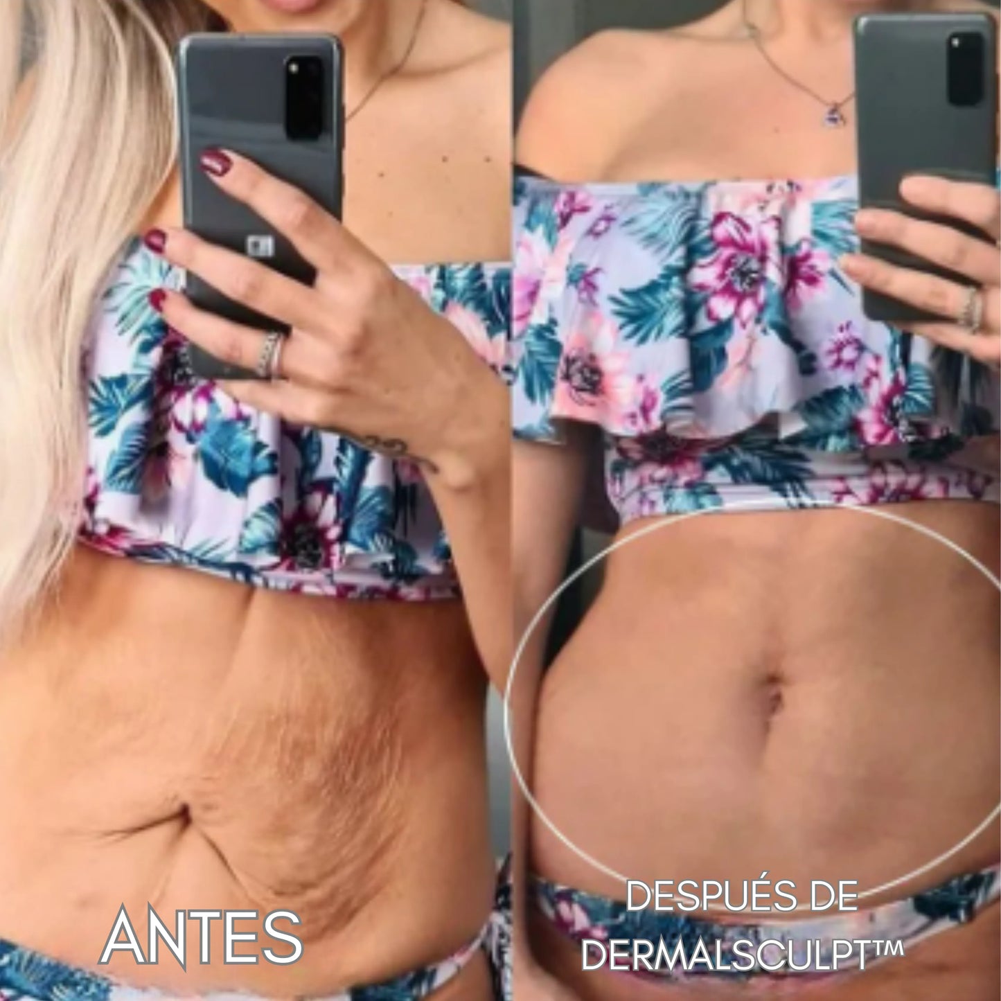 DERMALSCULPT™