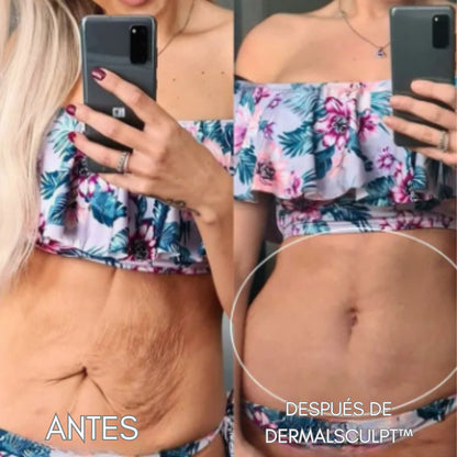 DERMALSCULPT™
