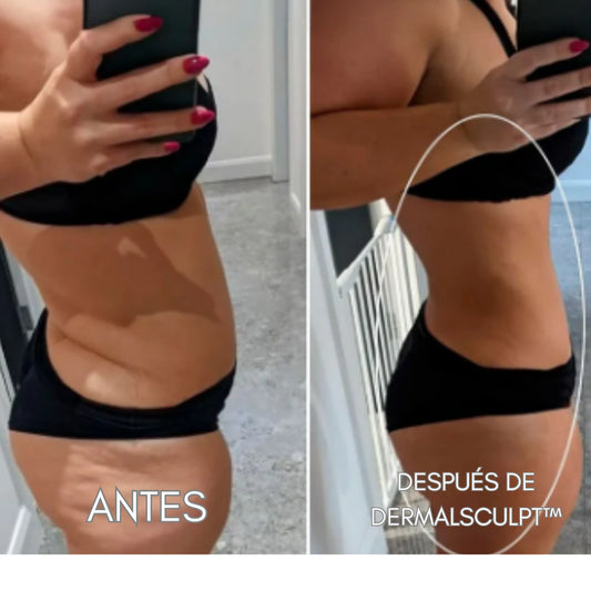 DERMALSCULPT™