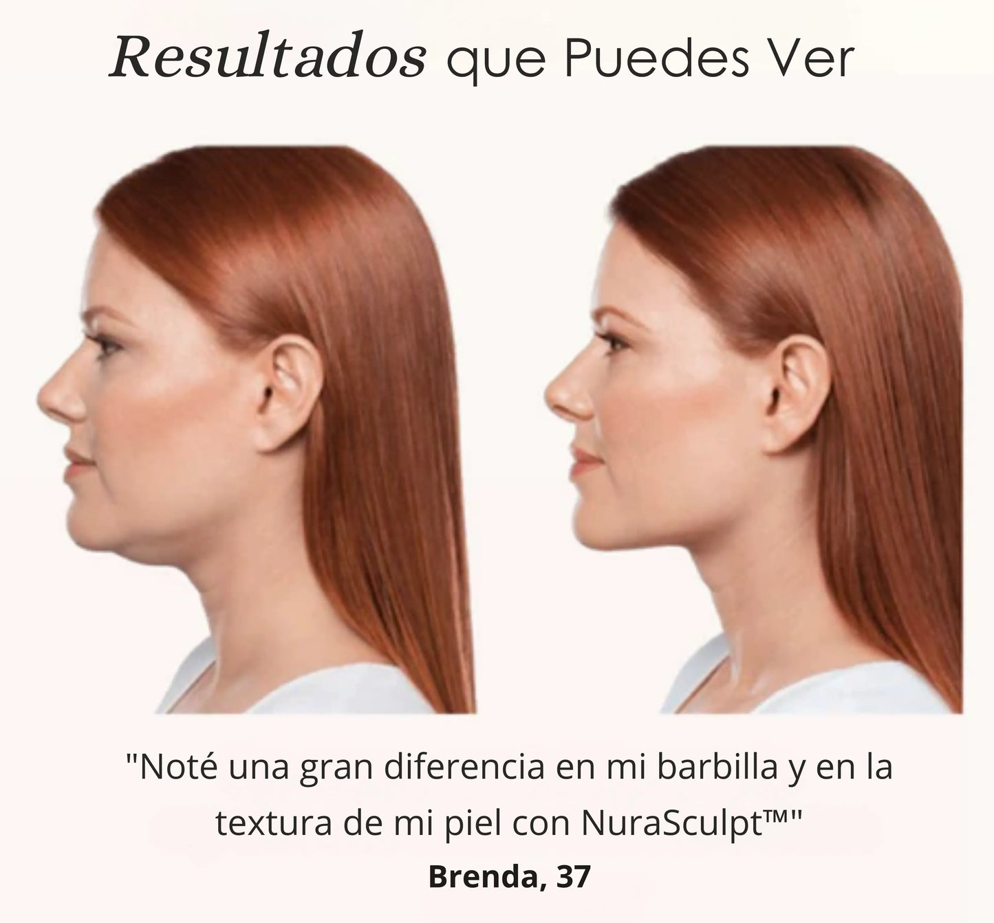 NuraSculpt™ Cuello Lifting