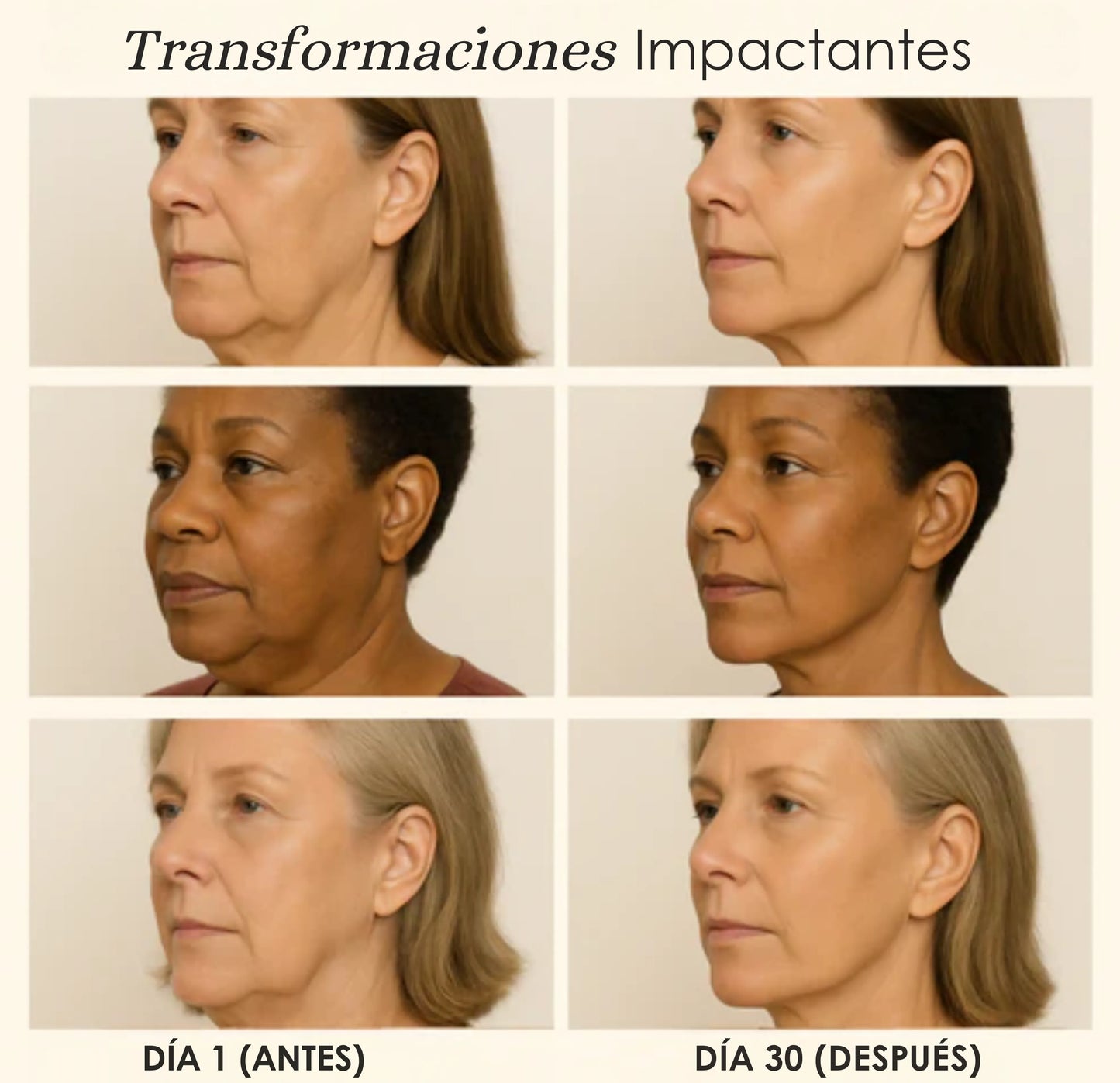 NuraSculpt™ Cuello Lifting